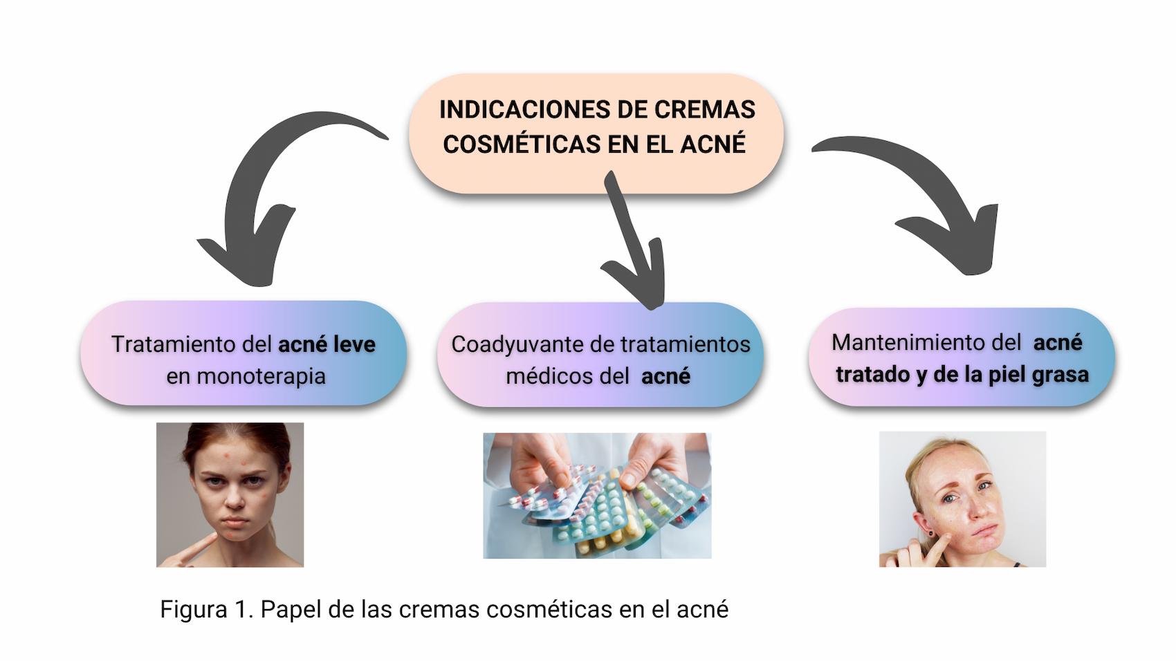 Indicaciones de cremas cosméticas en el acné