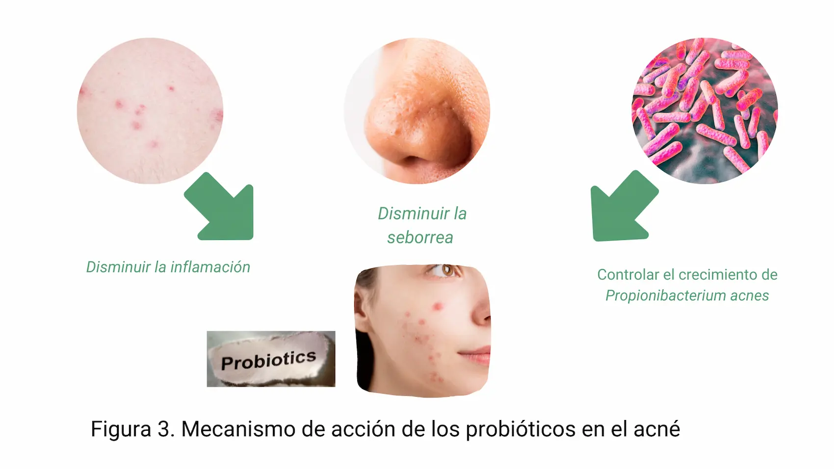 Mecanismo de acción de los probióticos en el acné