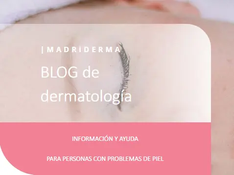 Blog de dermatología en español - madriderma