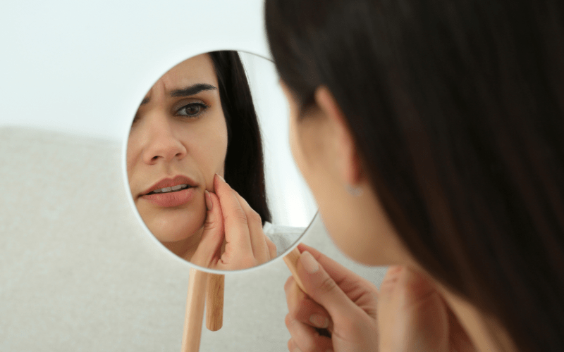 Cómo identificar y combatir el acné hormonal