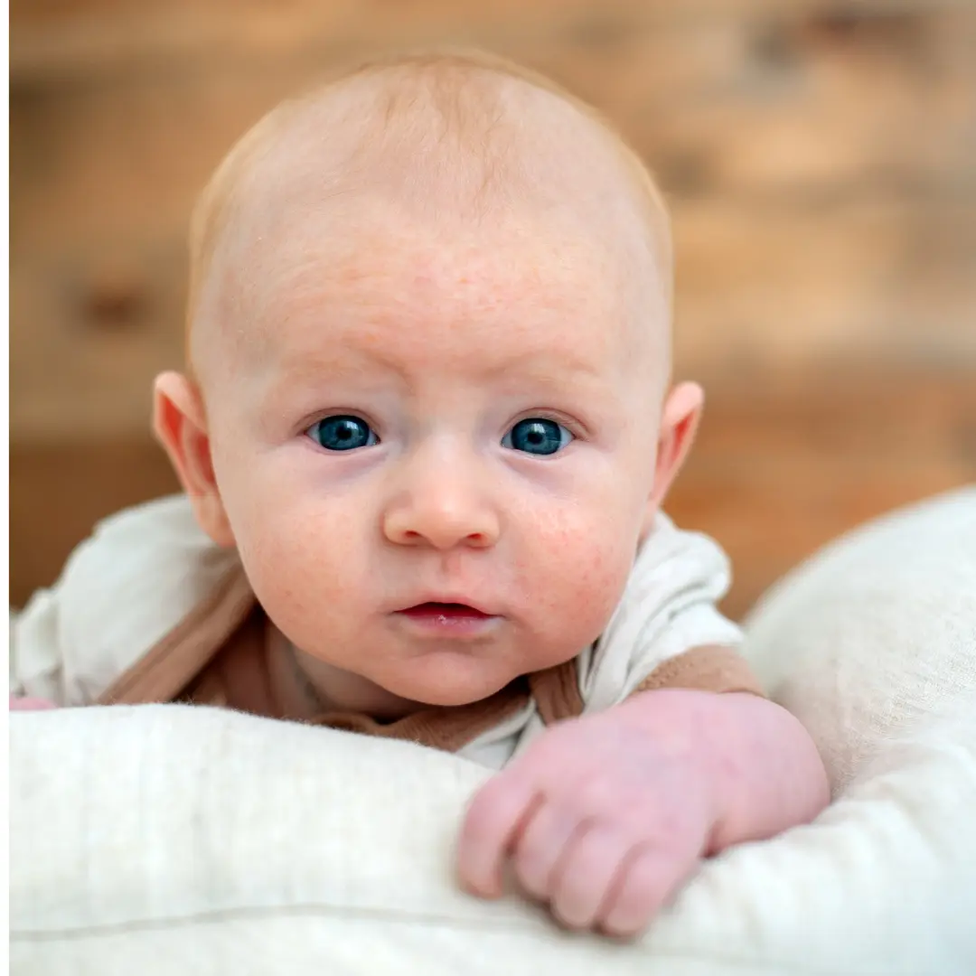 Ropa para dermatitis atopica