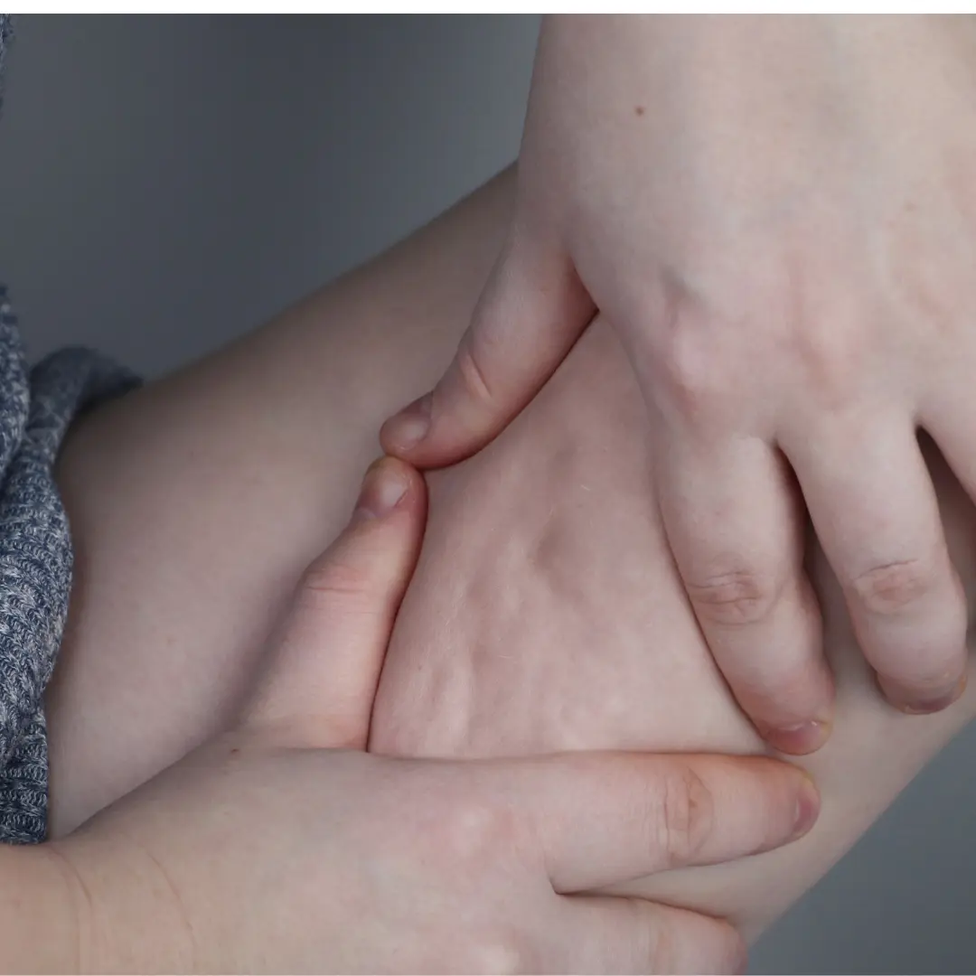 Piel de naramja hoyuelos