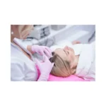 Mesoterapia capilar en la alopecia androgenica femenina
