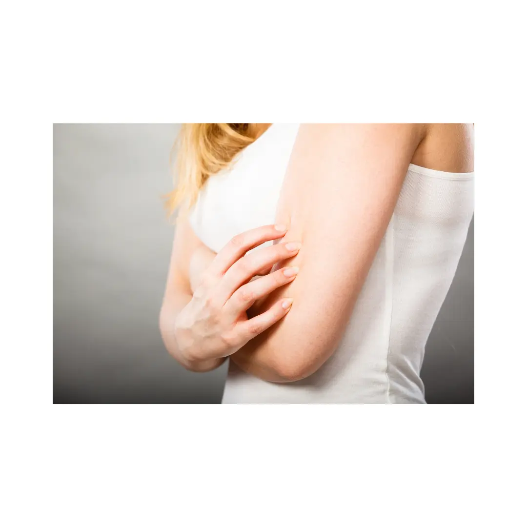 Calamina alivia picor e irritacion