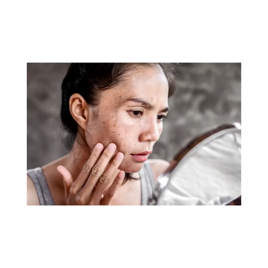 Mancha en la cara cuando consultar al dermatologo