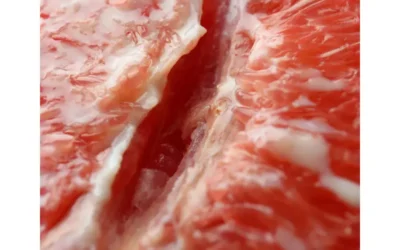 Dermatólogos Privados En Madrid | Madriderma 14 Liquen escleroso vulvar: lo que debes saber sobre esta enfermedad poco conocida