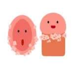 7 puntos para entender las verrugas genitales