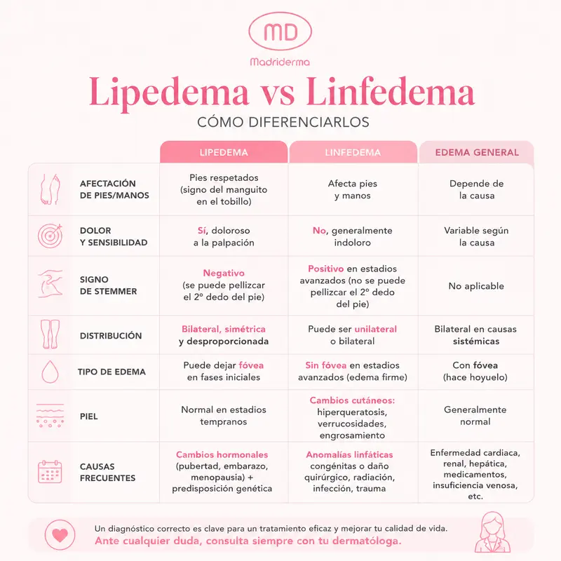 Lipedema vs linfedema